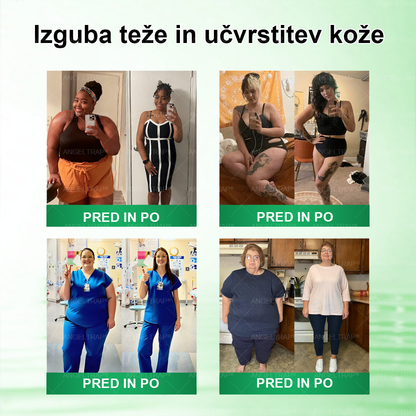 ANGELTRAP® Moringa × Berberin × AMPK 10-v-1 Metabolična podpora, obliž z nanotehnologijo mikroiglic 🇸🇮 (Dovolj je enkrat na dan, vidni rezultati v 7 dneh) ✅ Za debelost, ohlapno kožo, sladkorno bolezen, spalno apnejo, težave s sklepi in številne druge
